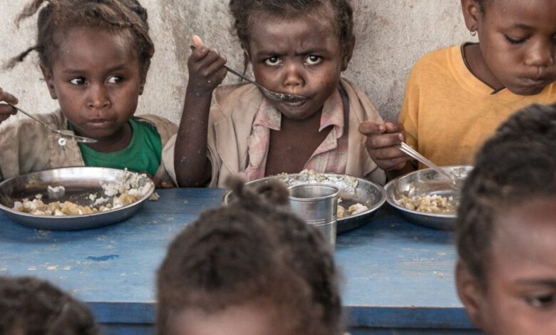 Starving African Boy: A Cry for Humanity Starving African Boy: A Cry for Humanity