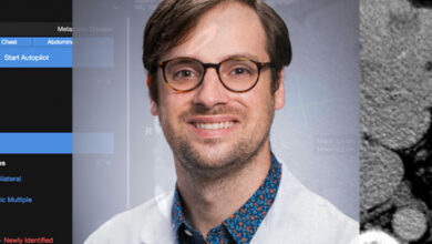 This radiologist is helping doctors see through the hype to an AI future